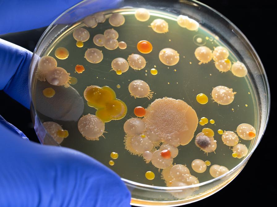 Billede af en petriskål med ulækkert snask i.